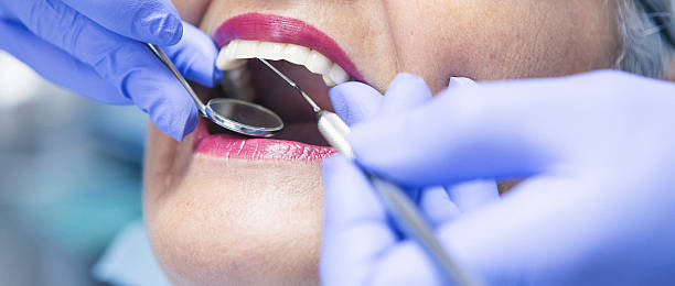 Best Emergency Dental Care for Abscessed Tooth in Cedar Hills, UT